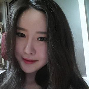 自體軟骨墊鼻尖手術(shù)前后對(duì)比果照片分享，看我的恢復(fù)過程~