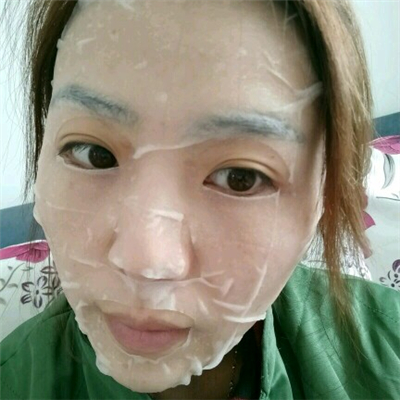 光子嫩膚和下巴脂肪填充術(shù)后果圖片分享，董萍門診做的~