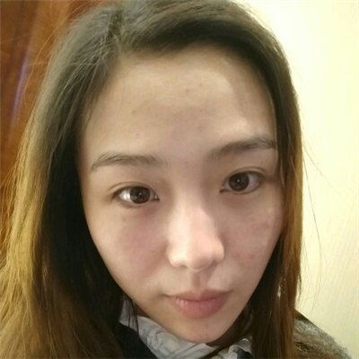 光子嫩膚和下巴脂肪填充術(shù)后果圖片分享，董萍門診做的~