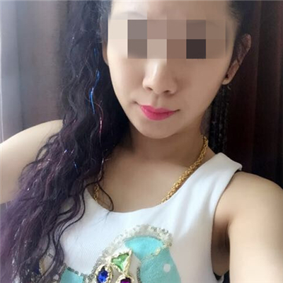 玻尿酸填充淚溝恢復(fù)過程和前后對(duì)比果圖片分享~