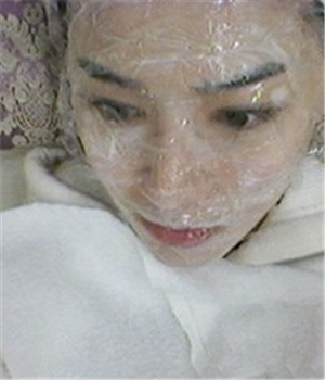 元旦做的光子嫩膚，分享恢復(fù)過(guò)程和前后對(duì)比果照片哦~