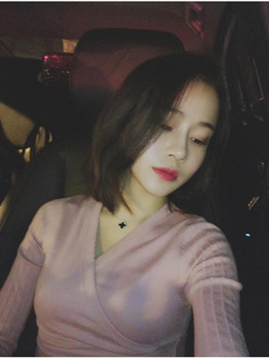 你們看看我做的綜合隆鼻手術(shù)怎么樣