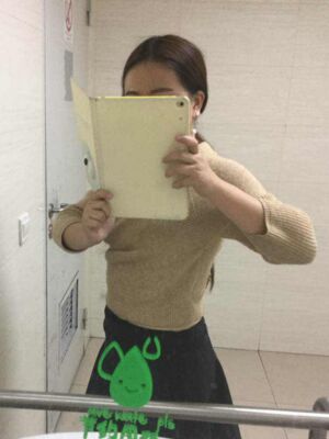 腰腹吸脂減肥果很好，恢復(fù)圖分享