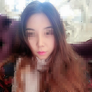 吸脂瘦臉手術(shù)半年了，分享前后對(duì)比果照片~