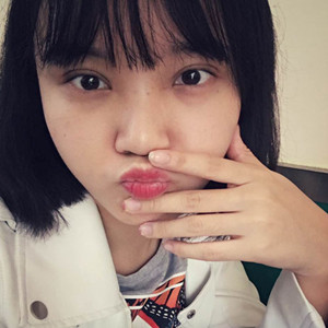 北京美萊做了雙眼皮手術(shù)，分享前后對比果圖片~