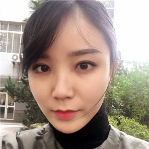 北京美萊做了雙眼皮手術(shù)，分享前后對比果圖片~