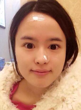 眉毛種植術前準備圖