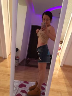 腰腹吸脂整形對比圖 肚子小了很多