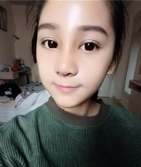 隆鼻整形日記，像變了個人似的