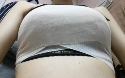 我的假體隆胸讓我從小平胸變深V 果還不錯(cuò)