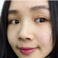 臉上激光去痣日志分享，一共去痣2次