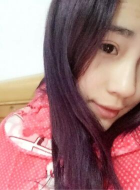 切開雙眼皮恢復(fù)過程 真實經(jīng)歷分享一下