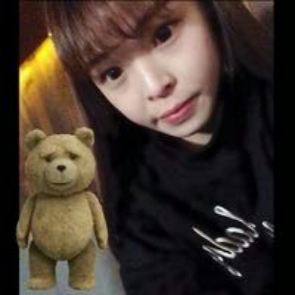 玻尿酸注射墊下巴和隆鼻前后對比果圖片分享，孫中生做的~