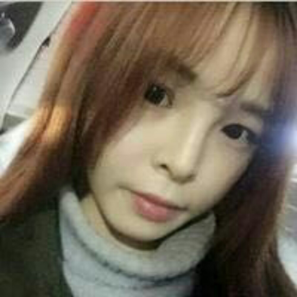 玻尿酸注射墊下巴和隆鼻前后對比果圖片分享，孫中生做的~