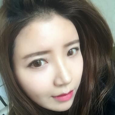 自體脂肪填充全臉1個(gè)月經(jīng)歷