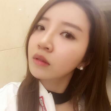 自體脂肪填充全臉1個(gè)月經(jīng)歷