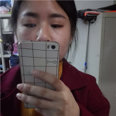 注射瘦臉去魚尾紋恢復(fù)過程和前后對比果圖片分享，上海東方做的~