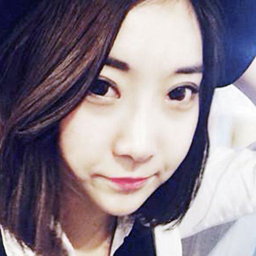 米蘭柏羽做了外切去眼袋，分享手術(shù)前后對(duì)比果圖片哦~