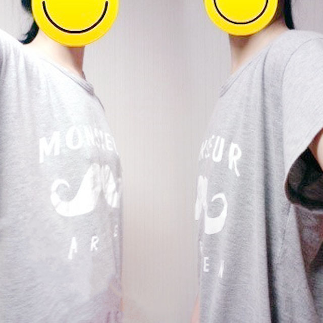 自體脂肪移植隆胸恢復(fù)過程和前后對(duì)比果圖片分享哦~