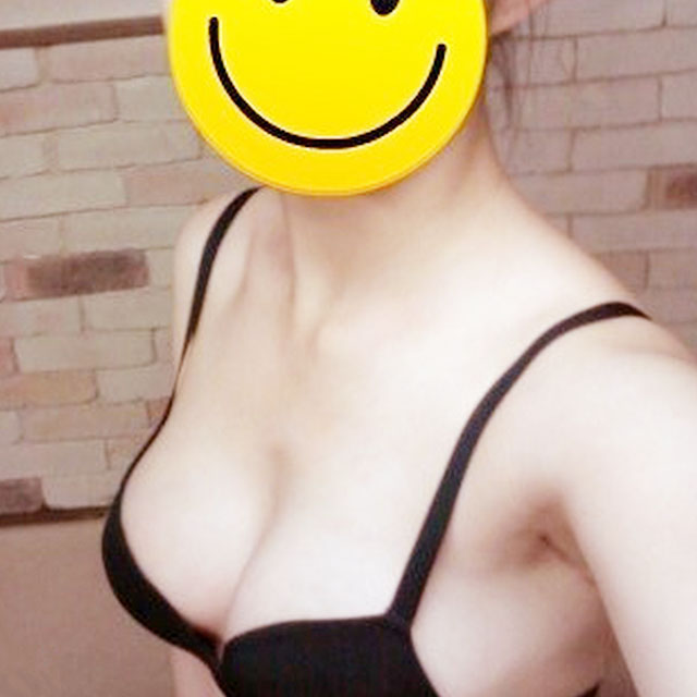 自體脂肪移植隆胸恢復(fù)過程和前后對(duì)比果圖片分享哦~