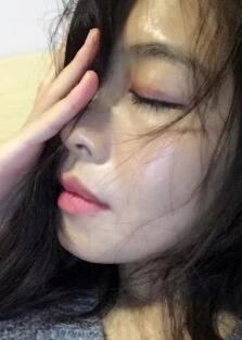 埋埋蛋白線.提升一個(gè)多月了