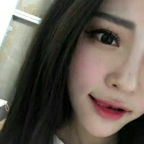 做了隆鼻整形手術(shù)好看多了，分享前后對(duì)比果照片~