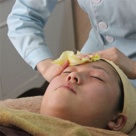 激光去雀斑前后對(duì)比果圖片分享，福州海峽林瓏醫(yī)生做的~