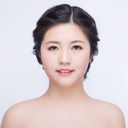 激光去雀斑前后對(duì)比果圖片分享，福州海峽林瓏醫(yī)生做的~