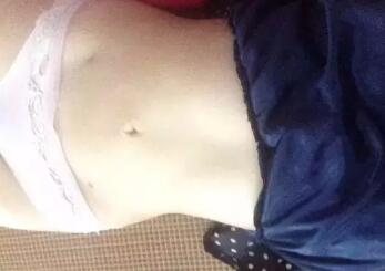 吸脂減肥恢復(fù)圖，腰上傷口還未完全恢復(fù)