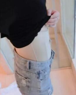 吸脂減肥瘦腰腹術(shù)后第7天