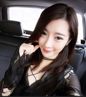 雙眼皮修復(fù)+自體脂肪填充恢復(fù)日記