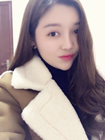 做了自體脂肪填充全臉果還不錯 現(xiàn)在請叫元氣少女