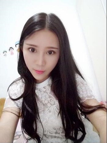 我的自體脂肪豐額頭+豐臉頰+雙眼皮+開眼角的真實經(jīng)歷 還有果圖哦