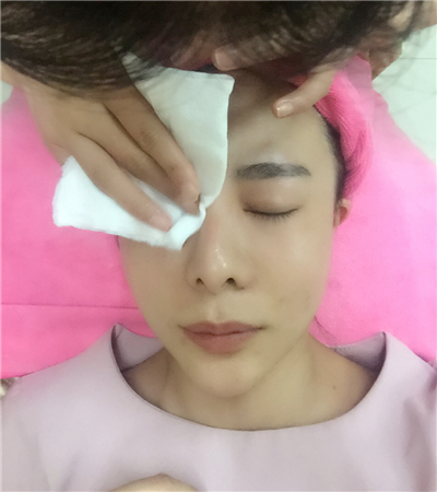 北京延世金慧燕做的果酸嫩膚，分享手術過程和前后對比果照片~