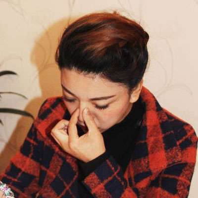 自體脂肪隆鼻手術(shù)恢復(fù)過程分享，還有前后對(duì)比果圖片哦~