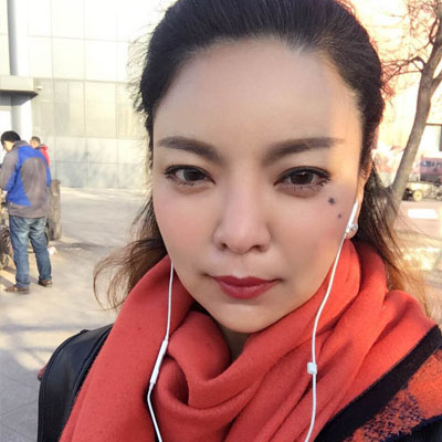 自體脂肪隆鼻手術(shù)恢復(fù)過程分享，還有前后對(duì)比果圖片哦~