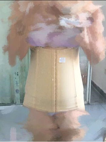 我的腰腹部吸脂減肥真實(shí)案例