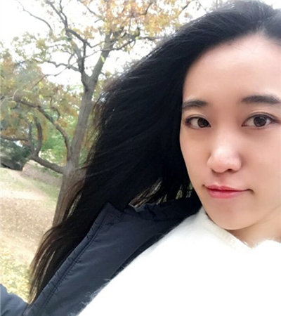 硅膠假體隆鼻手術(shù)恢復(fù)過程分享，還有前后對(duì)比果圖片哦~