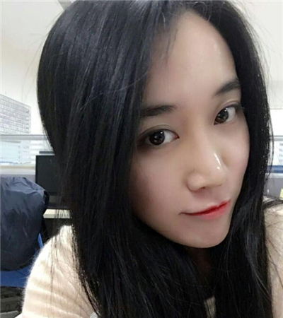 硅膠假體隆鼻手術(shù)恢復(fù)過程分享，還有前后對(duì)比果圖片哦~