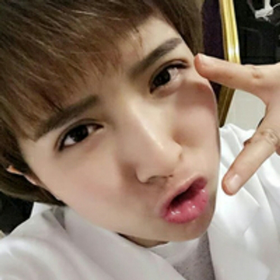 切開(kāi)雙眼皮恢復(fù)過(guò)程分享，還有前后對(duì)比果圖片哦~