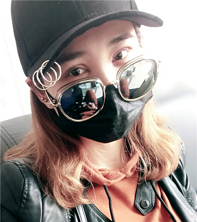 開(kāi)內(nèi)眼角+切開(kāi)雙眼皮前后對(duì)比果圖片分享，青島金島韓勝醫(yī)生做的~