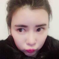 做自體脂肪豐太陽穴一段時間，整形過程分享給姐妹們參考下