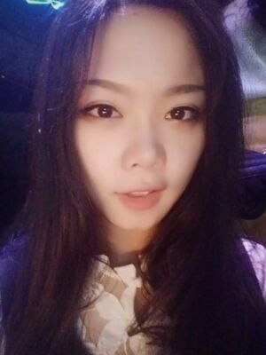 全切雙眼皮手術(shù)，送給自己的成年禮物