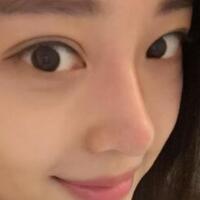 為什么大家覺得隆鼻恐怖，我就做了玻尿酸隆鼻，過程經(jīng)歷分享