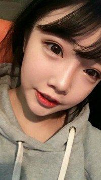 顴骨整形手術(shù)后，我也可以擁有精致小臉了