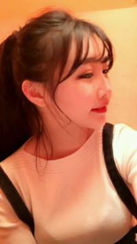 顴骨整形手術(shù)后，我也可以擁有精致小臉了