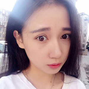 做雙眼皮兩個(gè)月了，分享恢復(fù)過程和前后對比果照片喲~