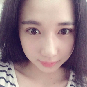 做雙眼皮兩個(gè)月了，分享恢復(fù)過程和前后對比果照片喲~