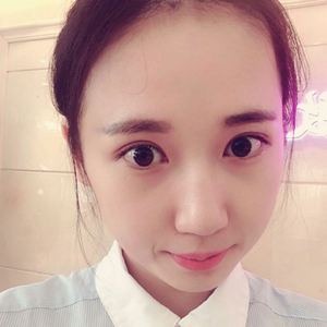 做雙眼皮兩個(gè)月了，分享恢復(fù)過程和前后對比果照片喲~