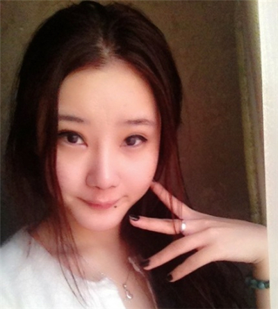 激光去雀斑+華爾茲冰點(diǎn)脫全身毛術(shù)后恢復(fù)過(guò)程照片分享~~